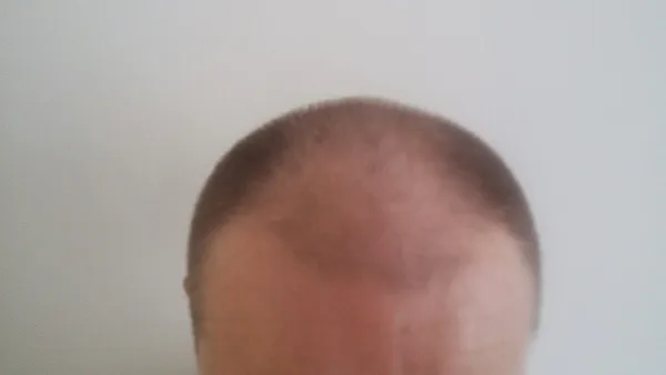 Muž 47 let